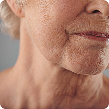 Aging